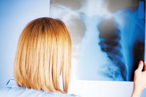 Σούπερ πρωτεΐνη τα βάζει με τον καρκίνο και κερδίζει