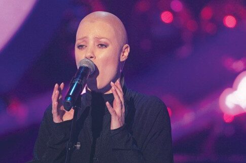 Φαλακρή και... πρώτη η Αντα Λιβιτσάνου ως Sinead O' Connor!