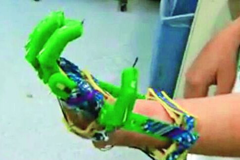«Τύπωσε» προσθετικό χέρι από 3D εκτυπωτή