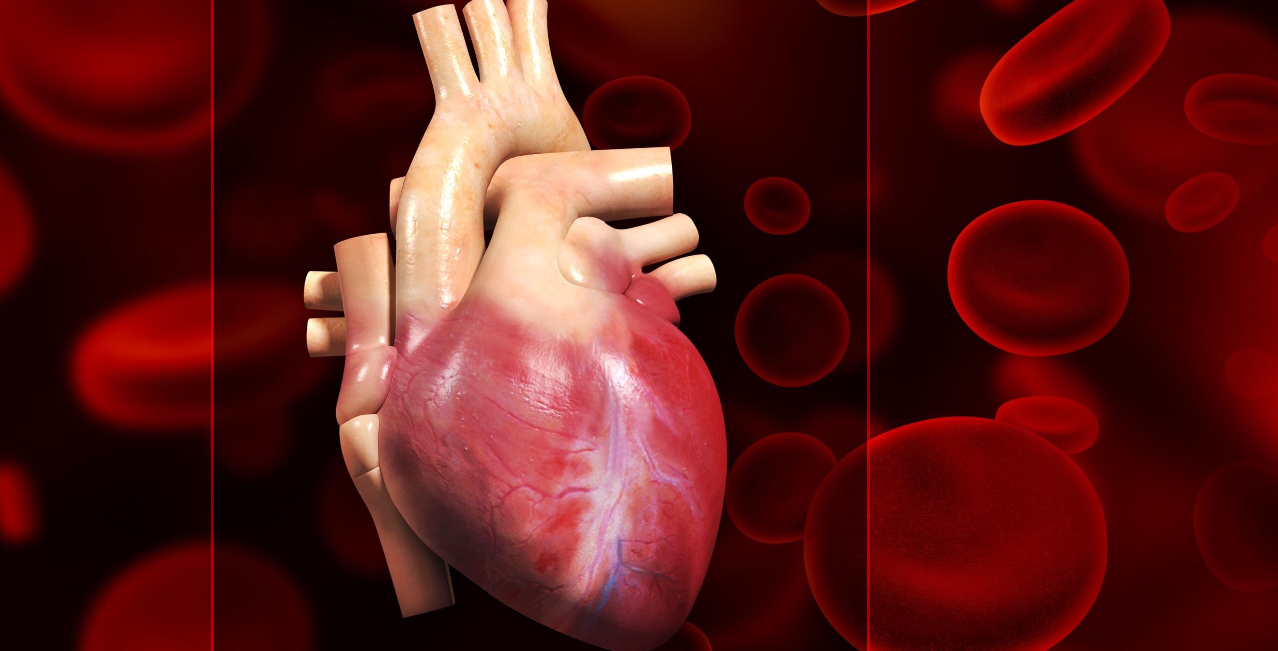 Επέμβαση συρρίκνωσης της καρδιάς