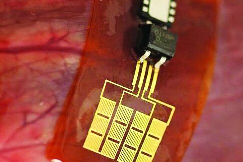 Εμφυτεύσιμη μπαταρία που φορτίζει τα gadgets