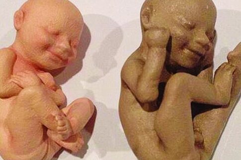 Print out 3D έμβρυα