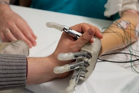 Βιονικό χέρι χαρίζει «αγγίζει» και νοικιάζει τα πάντα