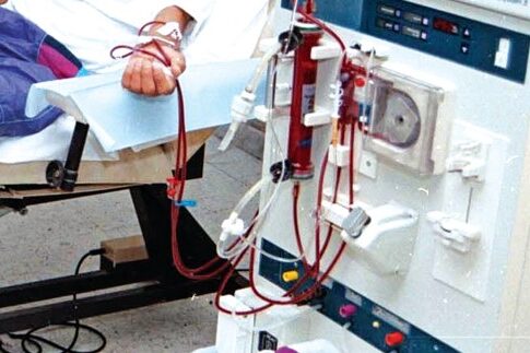 Χρησιμοποιούν νανοΐνες για αιμοκάθαρση