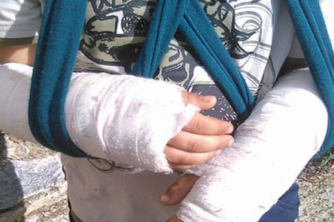 Σοκ στη Λέσβο με εννιάχρονο αγοράκι θύμα άγριου bullying