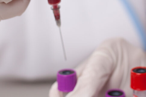 Το απόλυτο εμβόλιο για το AIDS