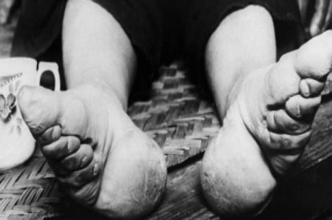 Ο πραγματικός λόγος πίσω από το έθιμο με τα «δεμένα πόδια» στην Κίνα