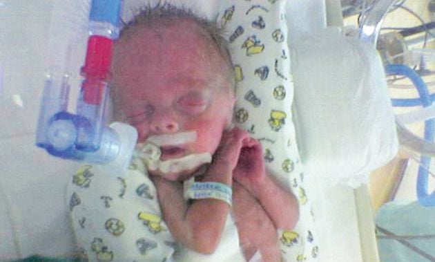 Ο νεογέννητος στη θερμοκοιτίδα