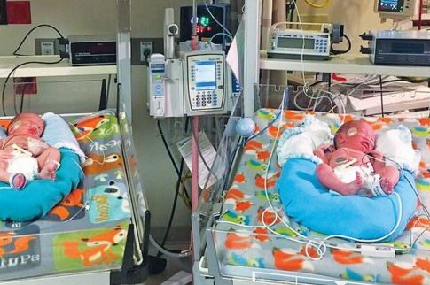Τα δίδυμα αδέλφια που γεννήθηκαν διαφορετική χρονιά