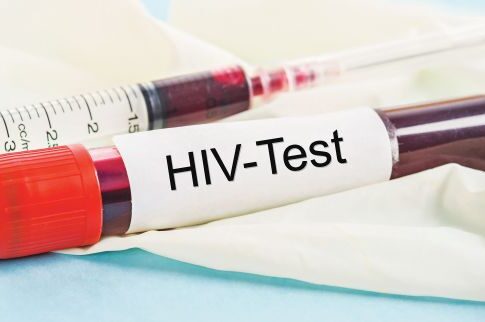 Μείωση στα κρούσματα HIV