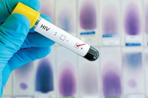 Συναγερμός για τον HIV