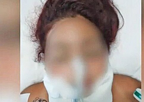 Ξύπνησε από το κώμα η νεαρή που κακοποιήθηκε άγρια στο Ζεφύρι από διακινητές ναρκωτικών