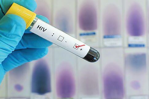 Ανοσοθεραπεία και για το AIDS