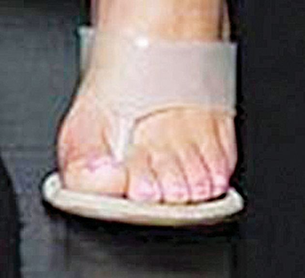 17507662 7377701 extra toe it was kim s left foot that drew attention she wore wh m 3 1566373369151
