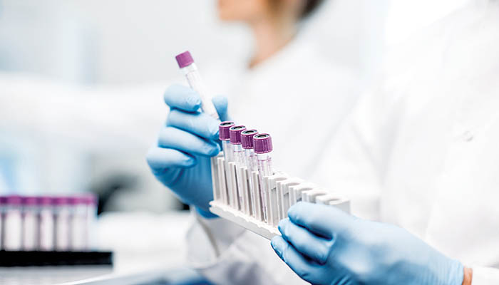 Με ειδική πτήση έφτασε στην Ελλάδα η χλωροκίνη από την Ινδία για την αντιμετώπιση του κορονοϊού