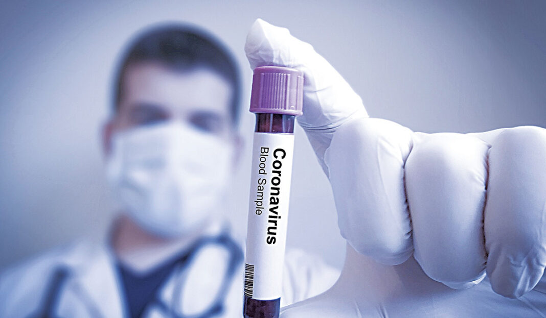 Ο άνθρωπος που βρήκε το AIDS απασφάλισε! «Ο Covid-19 φτιάχτηκε σε εργαστήριο της Ουχάν»