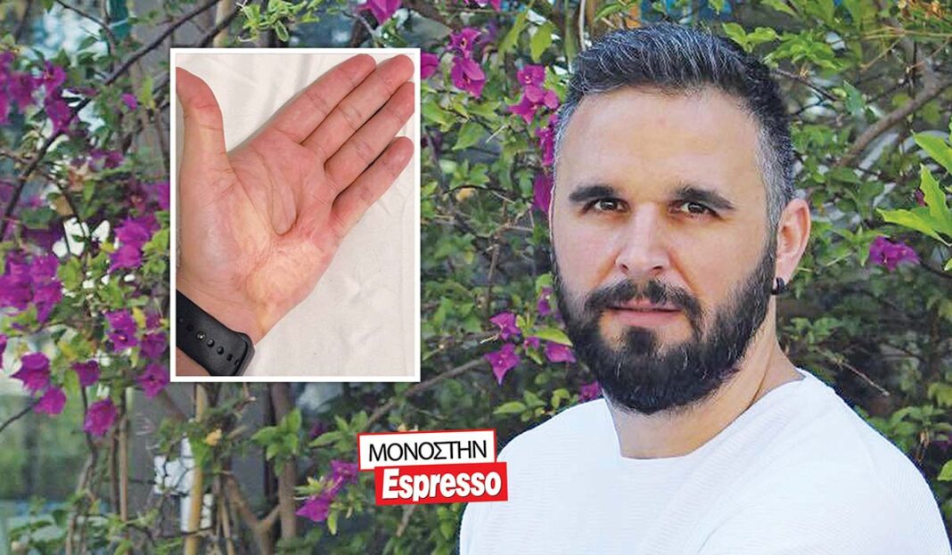 Η συγκλονιστική ιστορία του τραγουδιστή Χρήστου Χρυσάφη με το θεϊκό σημάδι στην παλάμη