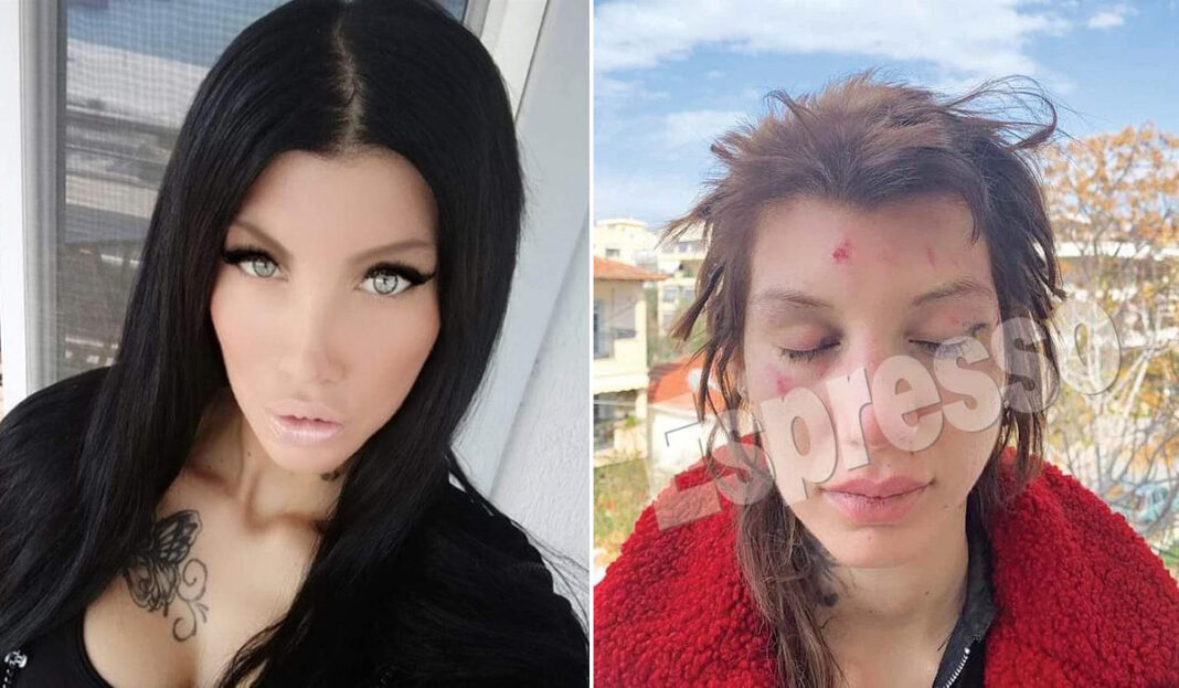 Απιστίες, κατάρες και απειλές! Οι γυναίκες που η Μαρία Αλεξάνδρου κατηγορεί για άγριο ξυλοδαρμό περνούν στην αντεπίθεση