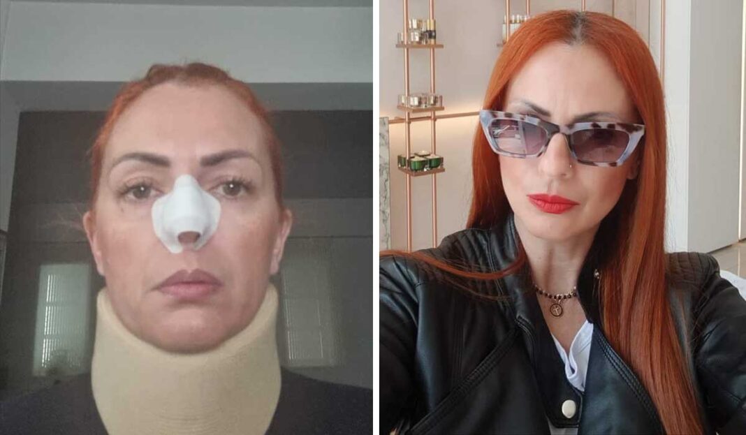 Τσάκωσαν τον Πακιστανό «δράκο» της Κρήτης που ξυλοκόπησε μπαρμπέρισσα!