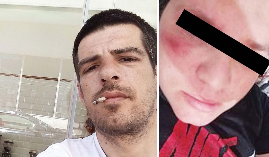 Θύμα άγριου ξυλοδαρμού η μάρτυρας «κλειδί» στο θρίλερ του θανάτου του Κώστα Δασκάλου στην Καβάλα