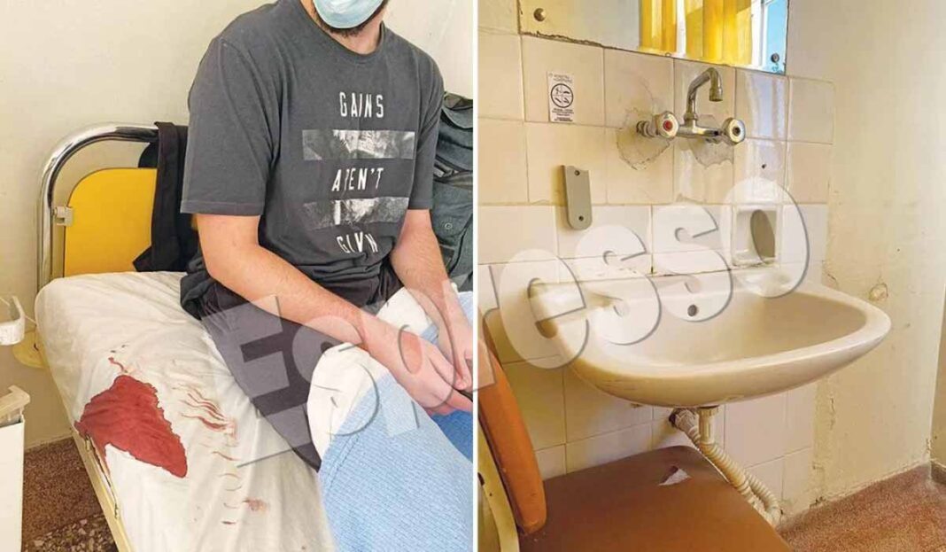 Τριτοκοσμικές εικόνες στο ΚΑΤ! Ματωμένα σεντόνια – Τα πάντα ξεχαρβαλωμένα