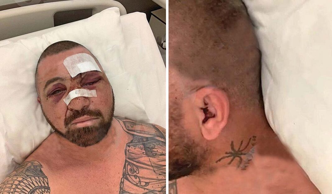 Συγκλονίζει ο bodyguard του Μπιλζέριαν μέσα από το νοσοκομείο: «Τέτοιο ξύλο δεν έχω φάει ποτέ»