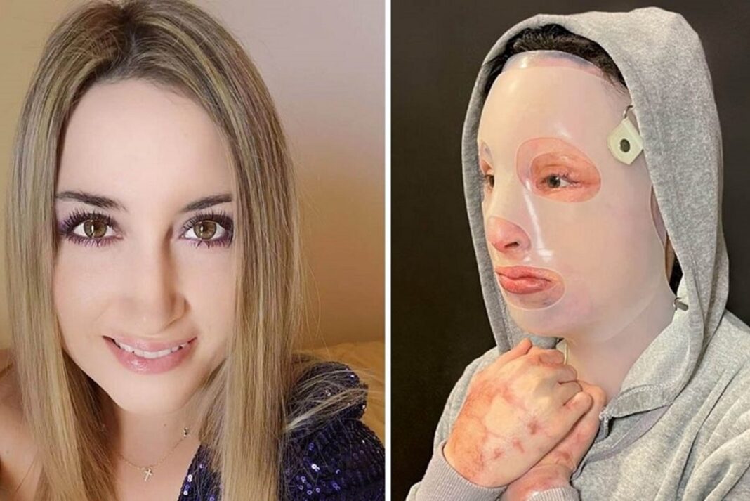 Επίθεση με βιτριόλι - Οι συνομιλίες της Ιωάννας με τον άντρα που αποτέλεσε το μήλον της έριδος (video)