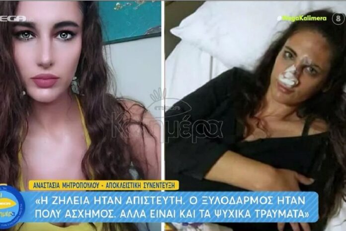 Ναστάζια Μητροπούλου – «Κόντεψα να μείνω παράλυτη με το ξυλοδαρμό από τον πρώην σύντροφό μου»