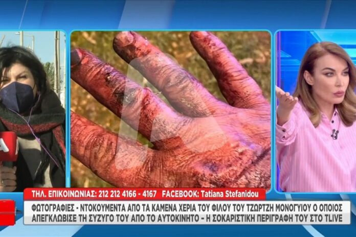 Τζώρτζης Μονογυιός: Τα εγκαύματα στα χέρια του φίλου που τους απεγκλώβισε από τη Ferrari
