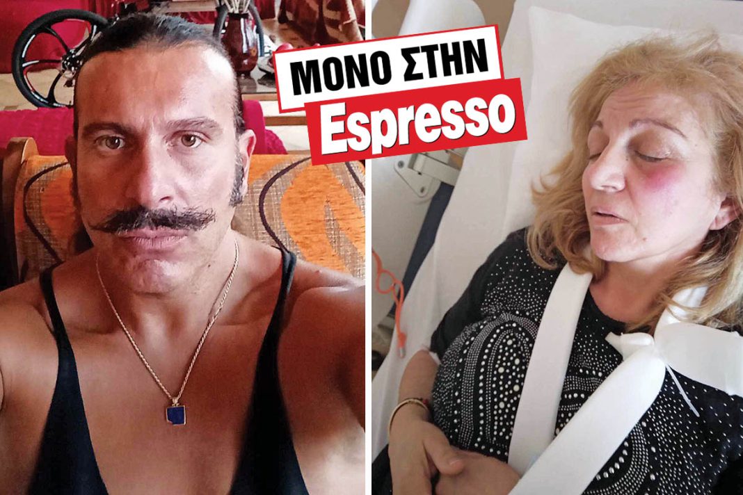 Kαταγγελίες από μητέρα ηθοποιού αισθησιακών ταινιών για άγριο ξυλοδαρμό της από ξενοδόχο
