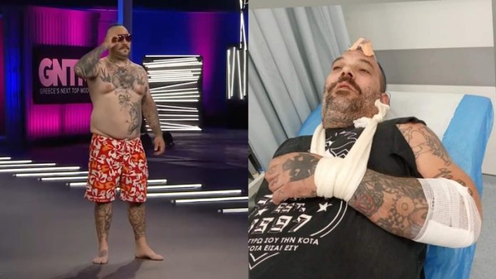 Λαχτάρα για πρώην παίκτη του «GNTM» - Ασυνείδητος οδηγός χτύπησε τον Τάκη Χήρα και τον εγκατέλειψε