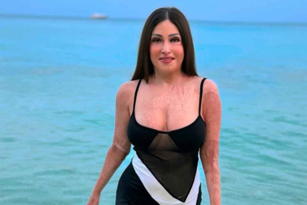 Ιωάννα Παλιοσπύρου: «Έμαθα να αγαπάω ξανά το σώμα μου»