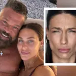 Βαλεντίνη Παπαδάκη: Έκανε μπότοξ και δείχνει το αποτέλεσμα - Τι άλλαξε στο πρόσωπό της