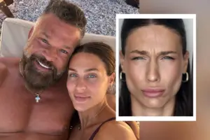 Βαλεντίνη Παπαδάκη: Έκανε μπότοξ και δείχνει το αποτέλεσμα - Τι άλλαξε στο πρόσωπό της