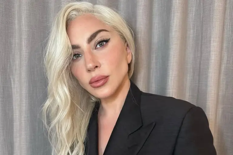 Lady Gaga: Χαμός με τη νέα της εμφάνιση – «Δεν μοιάζεις πια με την Gaga»