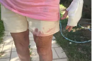 Ποινική δίωξη στη θεία του Στέφανου Τσιτσιπά -Για την επίθεση των σκύλων στη Βάρη